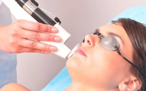 Effects on facial skin with laser tools