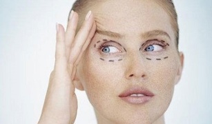 type of blepharoplasty to rejuvenate the skin around the eyes